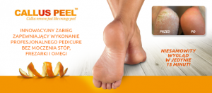 zabieg Callus Peel